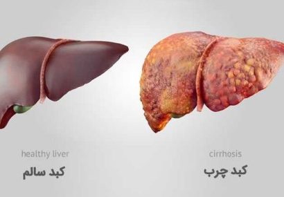 کاهش چربی شکم کلید مقابله با کبد چرب است/ مصرف میوه و سبزیجات راهی برای کاهش کبد چرب